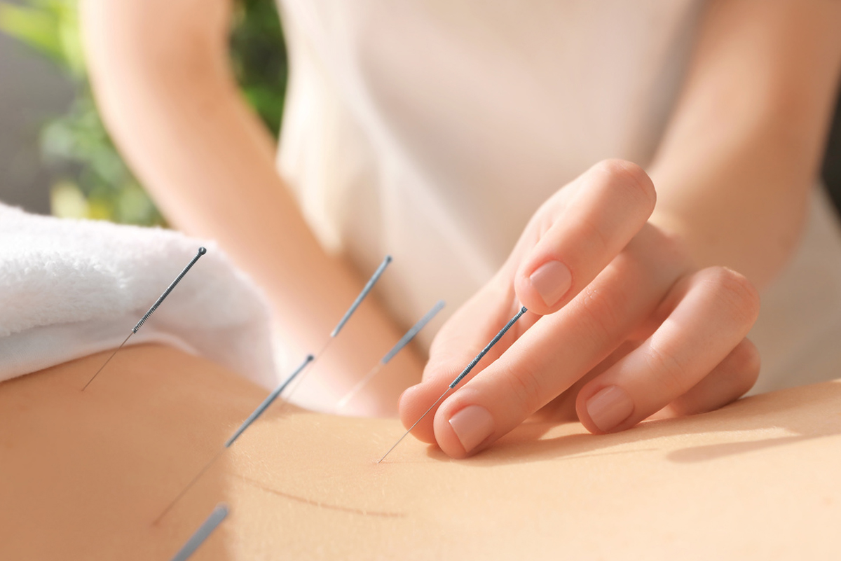 Three Realms Health acupuncture Three Realms Health acupuncture